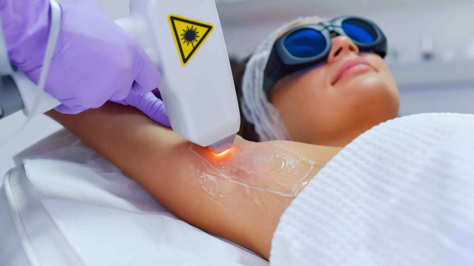 لیزر موهای زائد