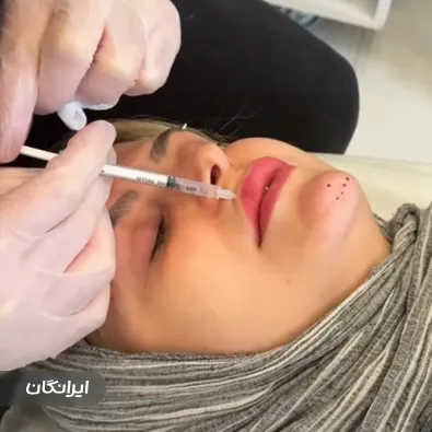 کلینیک زیبایی دکتر محسن غلامین