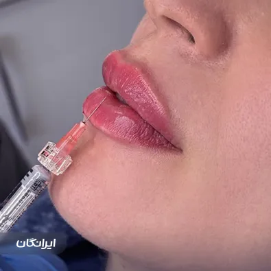 کلینیک زیبایی دکتر رعنا حقیقت پور