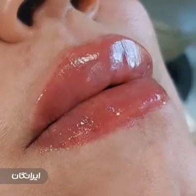 کلینیک زیبایی دکتر زینب فرخ