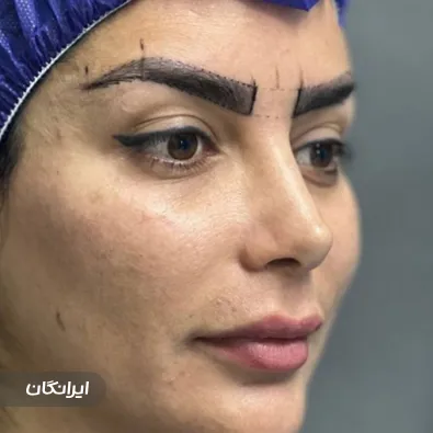 کلینیک زیبایی پرنیان نو