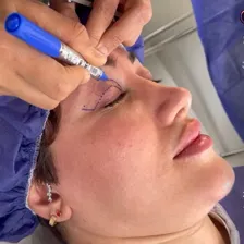 کلینیک جراحی پلک مشایخی