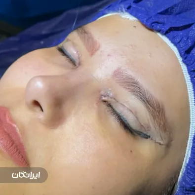 کلینیک جراحی پلک مشایخی