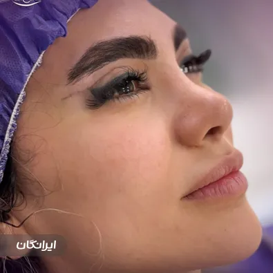 کلینیک جراحی پلک مشایخی