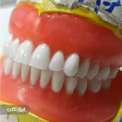 دندانسازی قاسمی