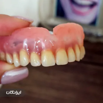 دندانسازی قاسمی