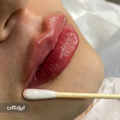 کلینیک زیبایی لیزا