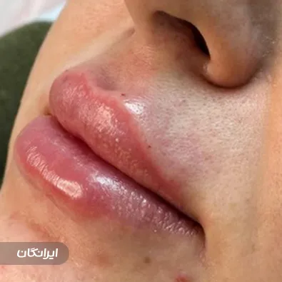 کلینیک زیبایی لیزا