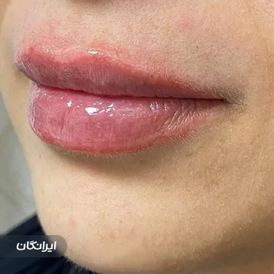 کلینیک زیبایی لیزا