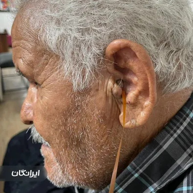 شنوایی سنجی رهام