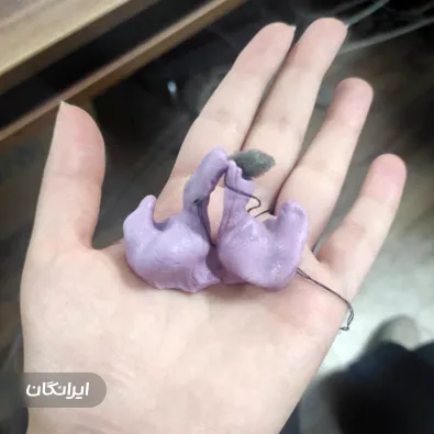 شنوایی سنجی رهام