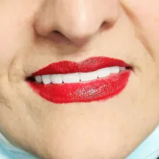 مرکز ایمپلنت و زیبایی ملاصدرا