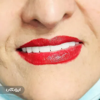 مرکز ایمپلنت و زیبایی ملاصدرا