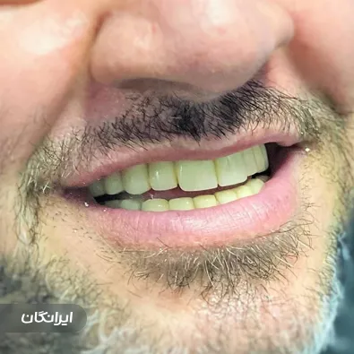 مرکز ایمپلنت و زیبایی ملاصدرا