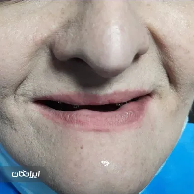 مرکز ایمپلنت و زیبایی ملاصدرا