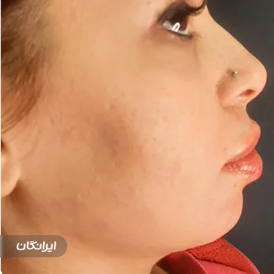 کلینیک زیبایی یسناطب