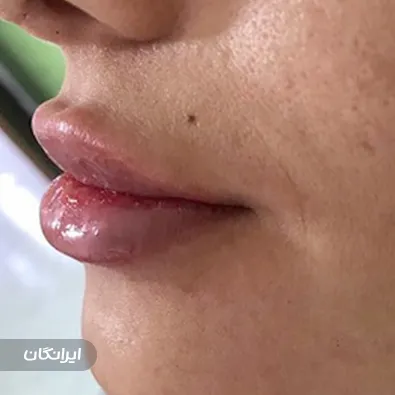 کلینیک زیبایی آویژه