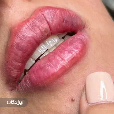 کلینیک زیبایی آویژه