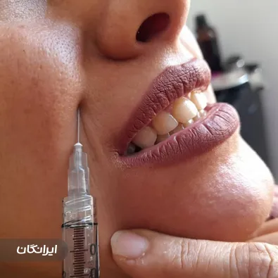 کلینیک زیبایی آویژه