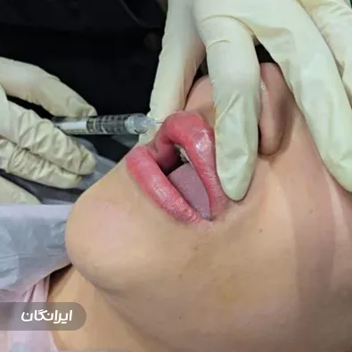 کلینیک زیبایی آلا