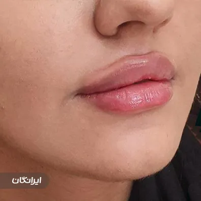 کلینیک زیبایی آلا