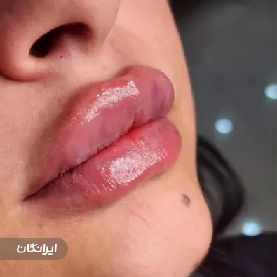 کلینیک زیبایی پریسان پونک