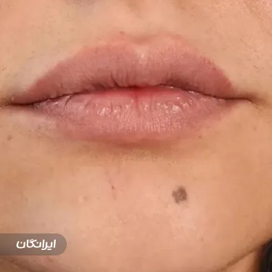 کلینیک زیبایی پریسان پونک