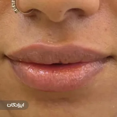 کلینیک زیبایی دکتر نیما حاجیها