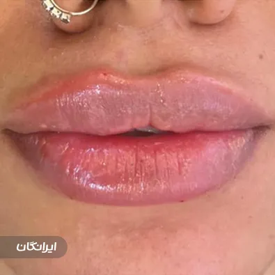 کلینیک زیبایی دکتر نیما حاجیها