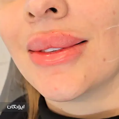 کلینیک زیبایی دکتر لیلا کریمی