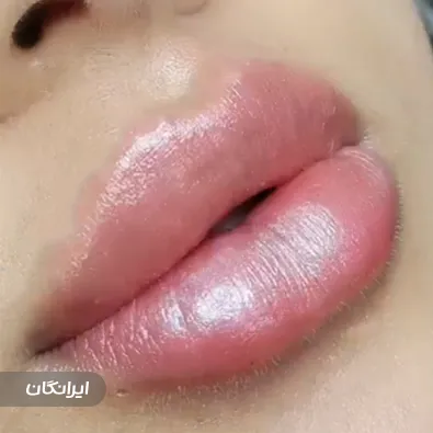 کلینیک زیبایی دکتر نگار وکیلی