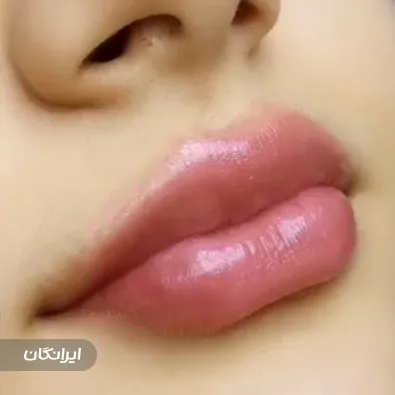 کلینیک زیبایی دکتر نگار وکیلی