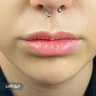 کلینیک زیبایی دکتر نگار وکیلی