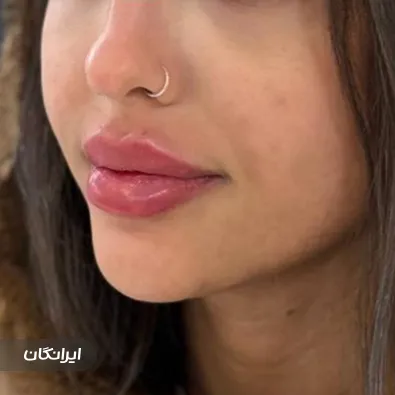 کلینیک زیبایی لاوین