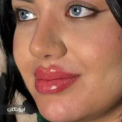 کلینیک زیبایی لاوین