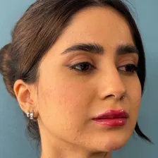 کلینیک زیبایی پایون