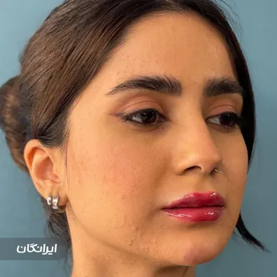 کلینیک زیبایی پایون