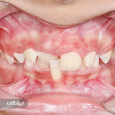 فتوگرافی پزشکی طب نگار