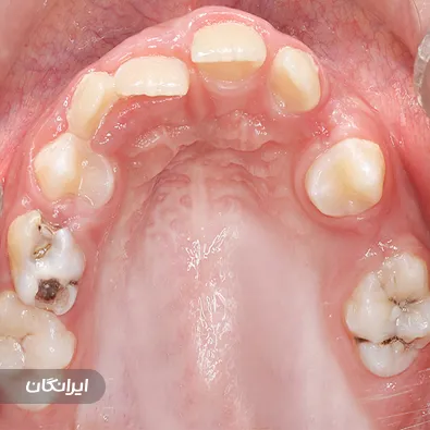 فتوگرافی پزشکی طب نگار