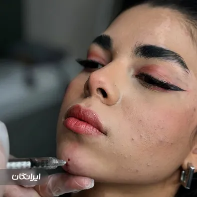 کلینیک زیبایی آپام