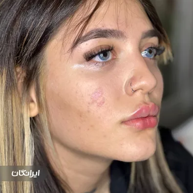 کلینیک زیبایی الماس