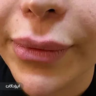 کلینیک زیبایی هستی