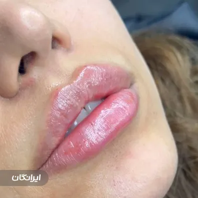 کلینیک زیبایی رز