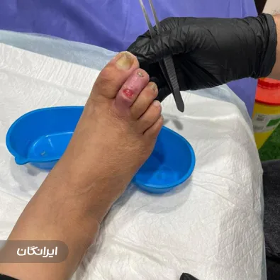 درمانگر زخم ناصر سلمانی