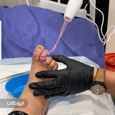 درمانگر زخم ناصر سلمانی