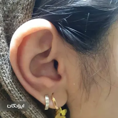 شنوایی سنجی و سمعک مقصودی