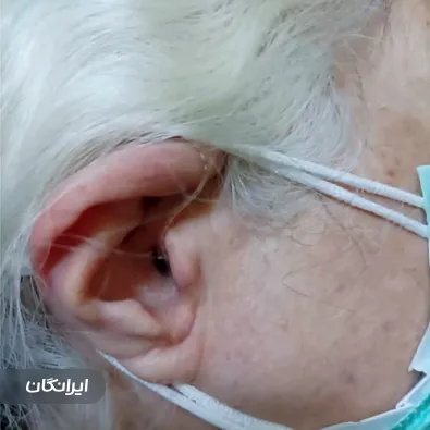 شنوایی سنجی و سمعک مقصودی