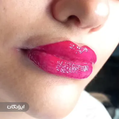 کلینیک زیبایی بیوتی فیس