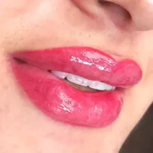 کلینیک زیبایی بیوتی فیس