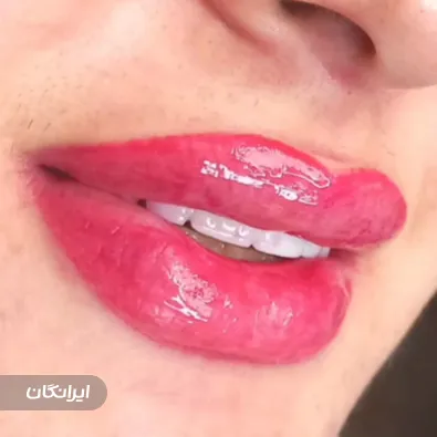 کلینیک زیبایی بیوتی فیس